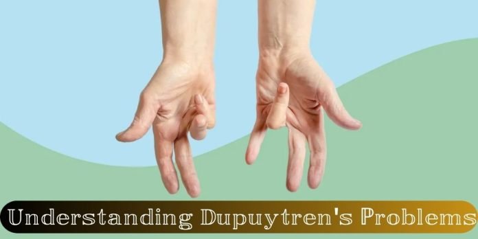 Understanding Dupuytren's Problems: Causes, Solutions, and Prevention